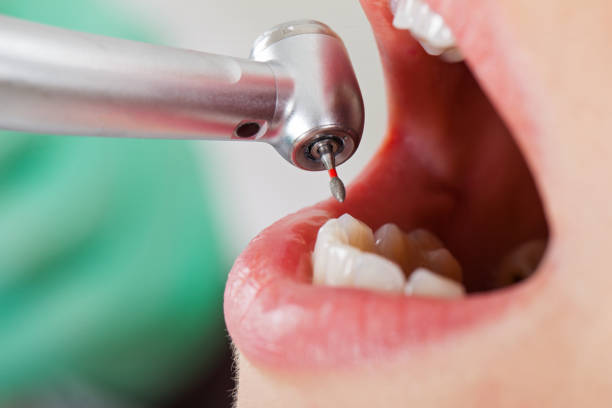 Best Pediatric Emergency Dentist in Trooper, PA
